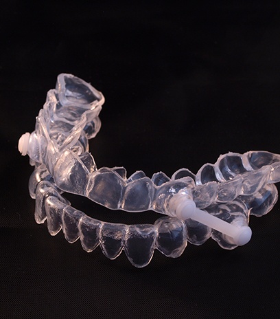 Close up of an oral appliance used for sleep apnea