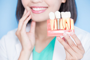 Female dentist holding model of dental implants